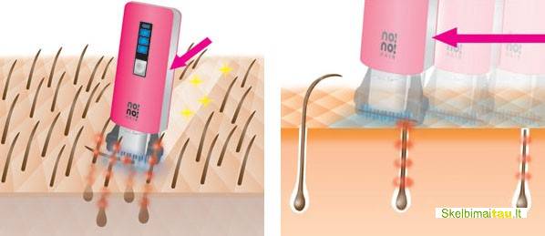 Lazerinis epiliatorius nono hair 8800